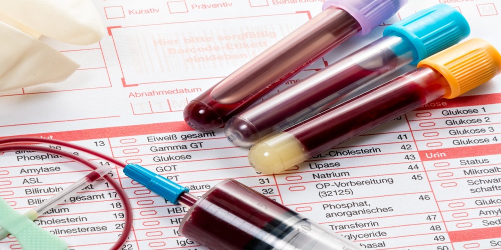 روشهای غیرجنسی انتقال HIV کدامند؟